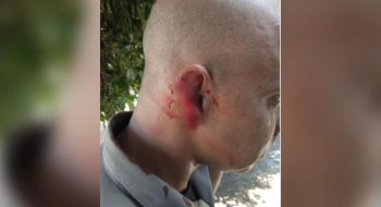 Homem arranca parte da orelha de policial durante abordagem, em São Miguel do Araguaia